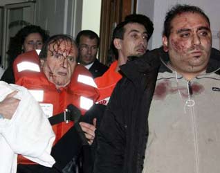 Feriti nell'incidente marittimo arrivano al Policlinico di Messina